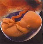 10 week unborn jpg